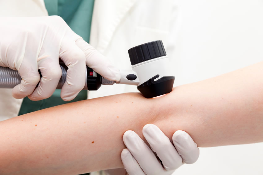Dermatoscopia cutanata. Clinica dermatologie Bucuresti