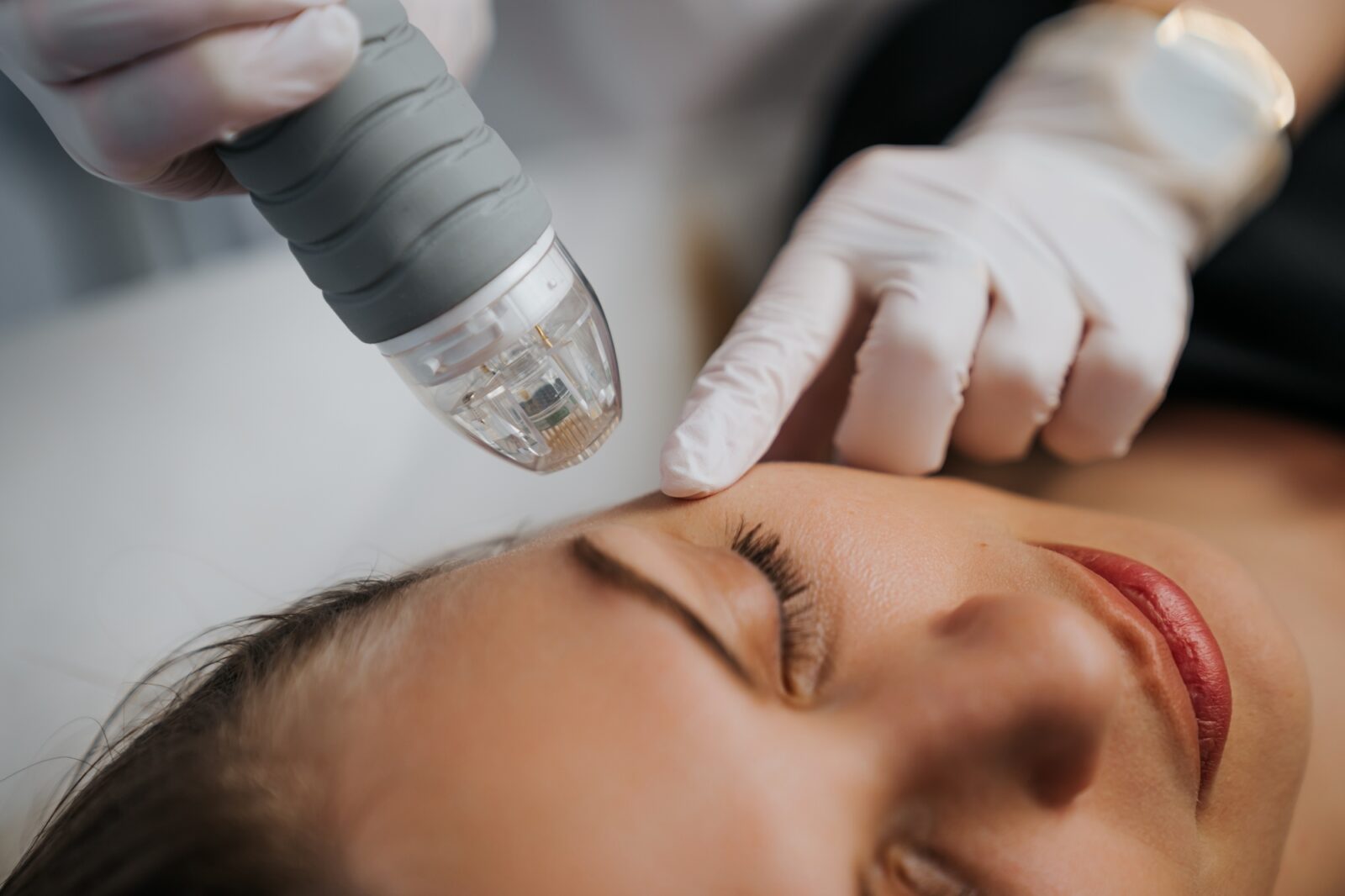 Radiofrecvență fracționată EndyMed Intensif – Clinica Dermestetica