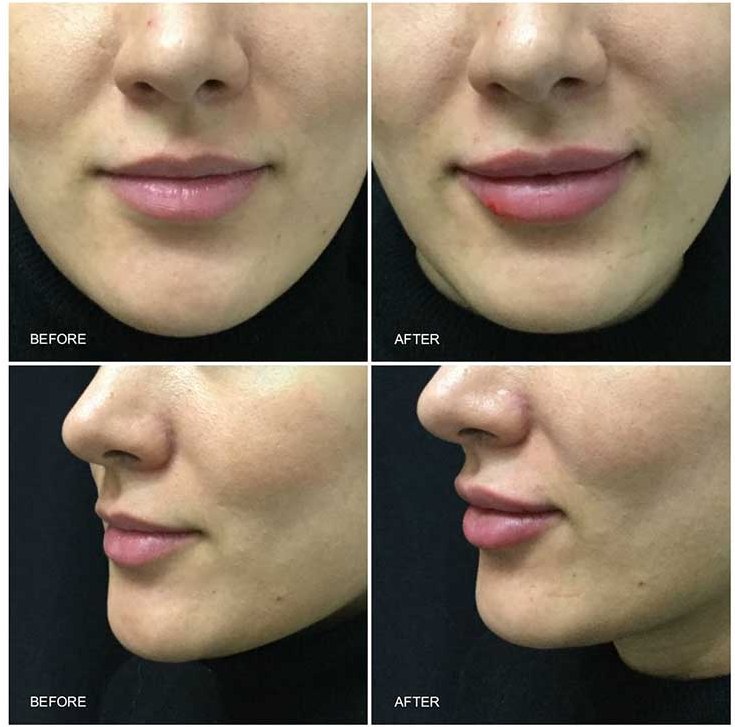 Proceduri de estetică medicală – Clinica Dermestetica